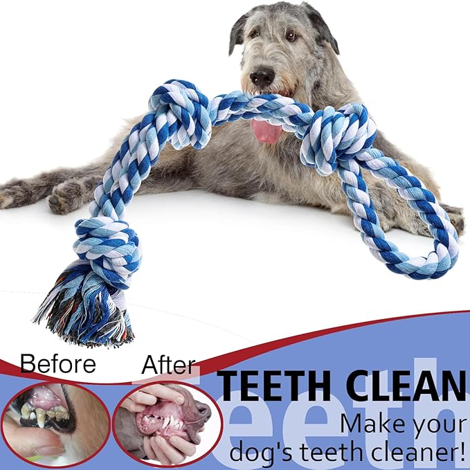 XIGOU Dog Rope Toy, 2 Pcs Indestructible Dogs Toys, Dog Chew Toys for Aggressive Chewers, Tough Puppy Teething Chew Toys for Boredom, Dental Cleaning Tug of War Dog Toy, Great for Small to Large Breed