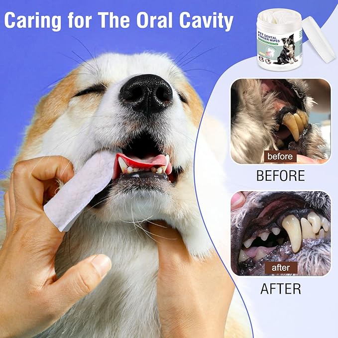 Pet Teeth Cleaning Finger Wipes for Dogs & Cats, Dog Dental Wipes for Removing Plaque and Tartar Buildup, No-Rinse Disposable Gentle Cleaning & Gum Care Pet Wipes, 50 Counts
